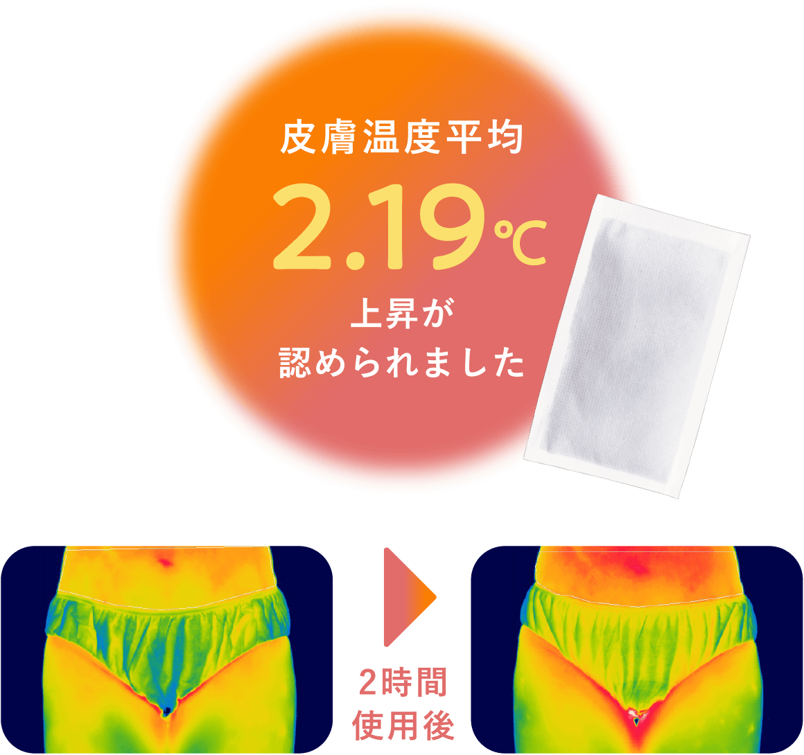 2時間後：皮膚温度平均2.19℃上昇が認められました